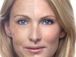 Pigmentation craicinn