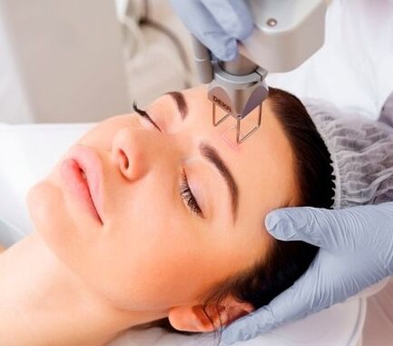 croílár an nós imeachta athnuachana craiceann facial léasair codánach